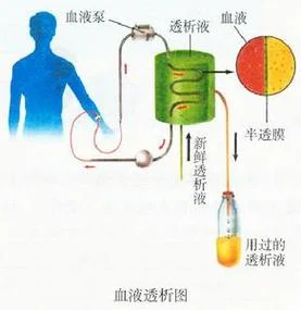 血透是什么原理_1
