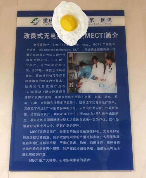 mect治疗一次要多少钱_2