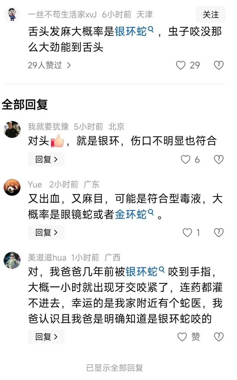 梦到自己被蛇咬到脚上_2