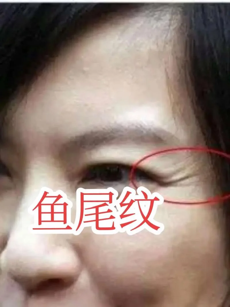 眼尾纹面相女图片高清-女眼尾纹高清面相