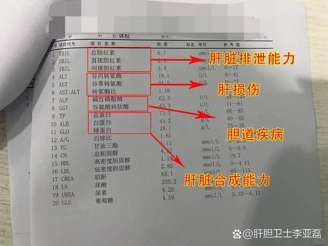 肝炎的检查项目有哪些-肝炎检查项目多