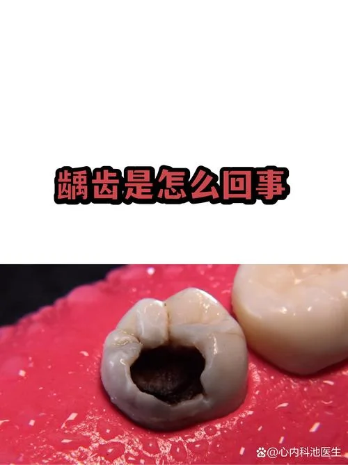 梦见蛀牙掉牙齿掉了_1