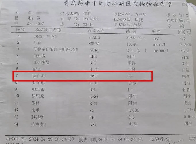 肾功能检查项目 八项-肾损八项检查