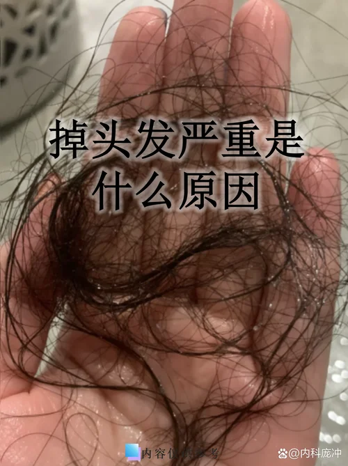 做梦梦见自己大量脱发_2