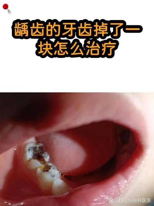 梦见牙齿掉了一块_1