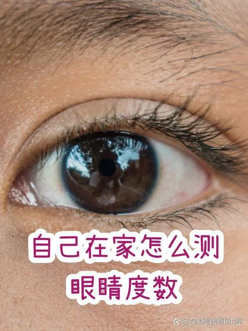 如何测出自己的视力-测视力方法