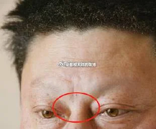 窝囊男人面相_1