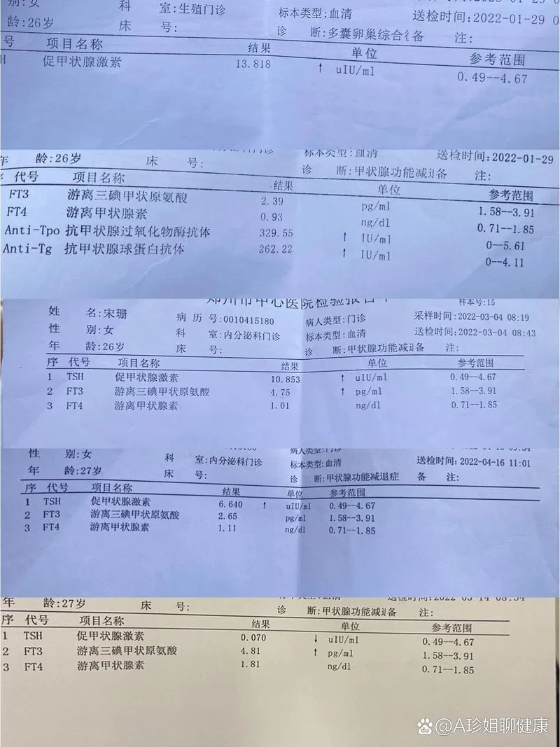 甲亢甲减检查多少钱_2