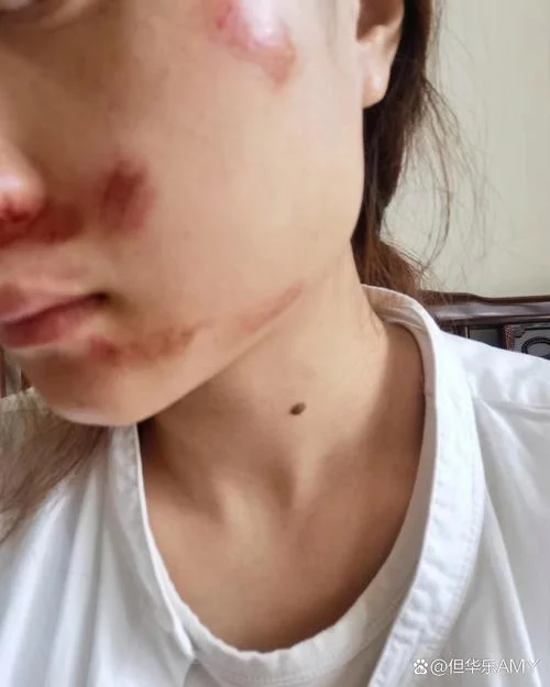 女人梦见自己挨打受伤_1