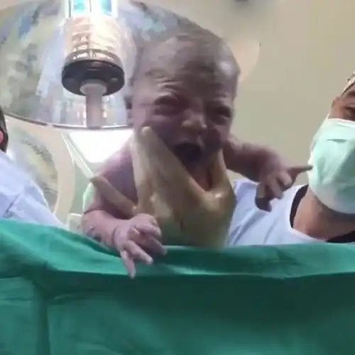 高颜值妈妈生出丑宝宝,怀疑医生抱错孩子,医生等满月再说