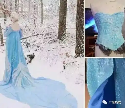 这位白化病女孩设计的衣服,明星都争相预约