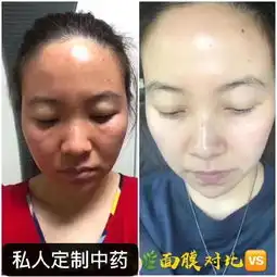 私人定制中药面膜可以天天敷吗