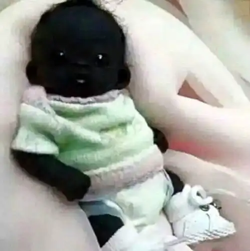 世界五大怪孩一个黑得像煤,一个二十岁还是婴儿,一个跟豹生活