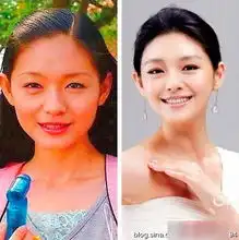明星假脸姐妹团整容前后3
