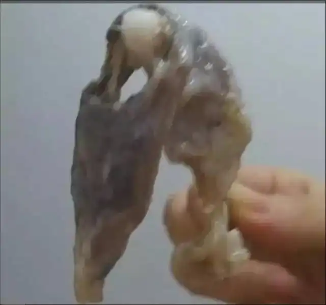 我的天子宫不洗澡您永远不知道这么脏幸好我有无限极女士灵芝皇