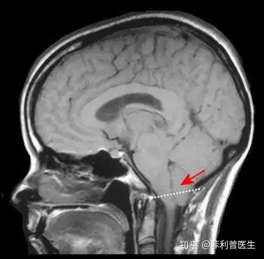 如何看待新闻母亲辅导儿子作业,因嫌其不认真,打死儿子,被判处缓刑三年