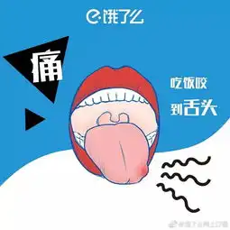 我想在饿了么点一份文案